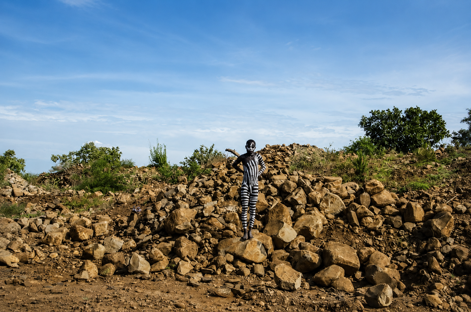 etiopia
